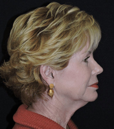 840