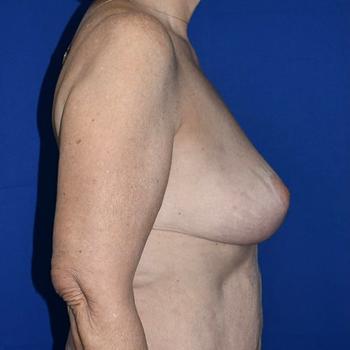 27972