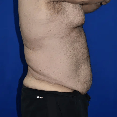 28033