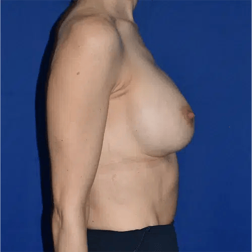 28435