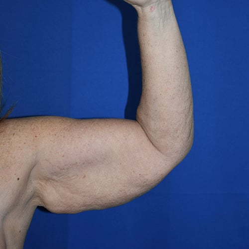 29224